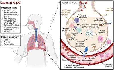 Hypoxia-adenosine axis as therapeutic targets for acute respiratory distress syndrome